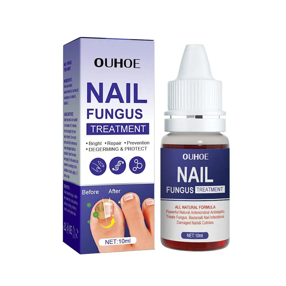 10PCS Nail Fungal Treatment Feet Care Essence Anti Infection Paronychia Toe Fungus Repair Nail Fungal Serum Removal Onychomy