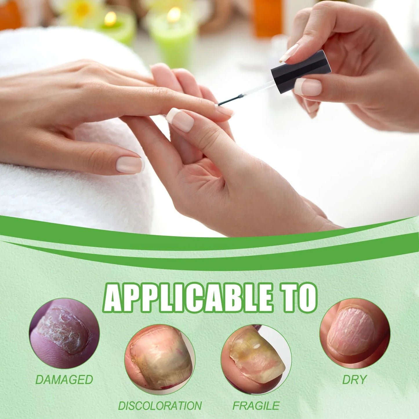 네일 15ML Nail Treatment Growth Formula Protein Normal Nail Strengthener Top Repair Serum Liquid Healthy Care Toe Cuticle Oil