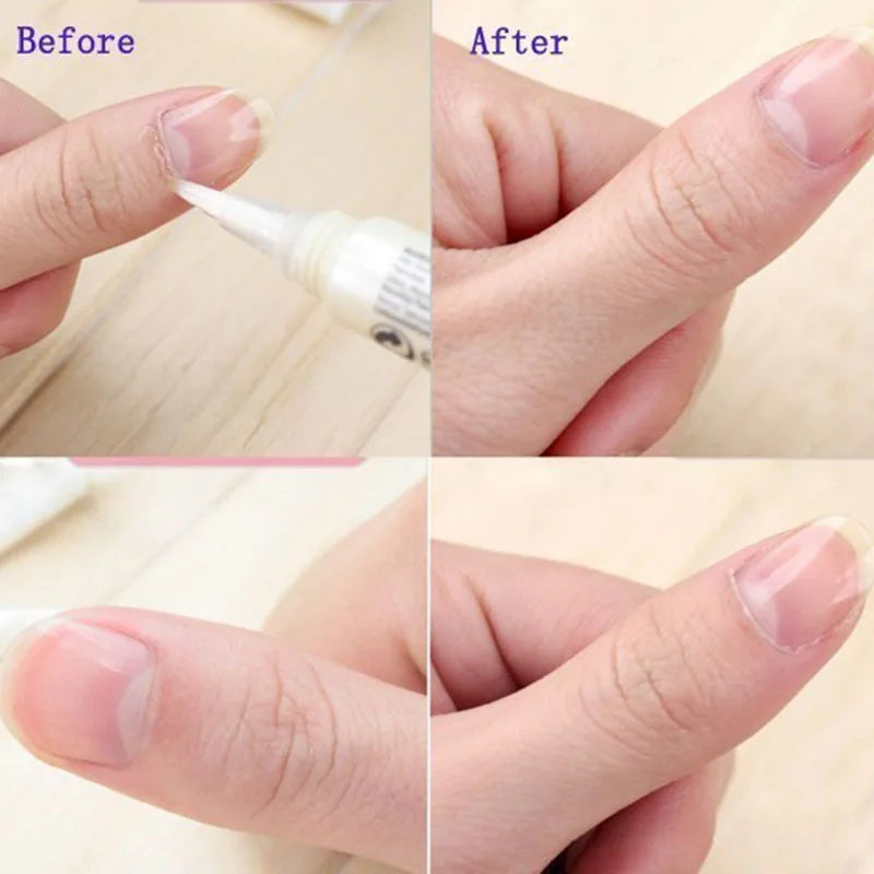 10Pcs/set Nail Care Nutrition Oil Pen Sweet Strawberry/Orange/Peach Flavor Nail Cuticle Oil Deep Moisturize Salon Cuticle Oil