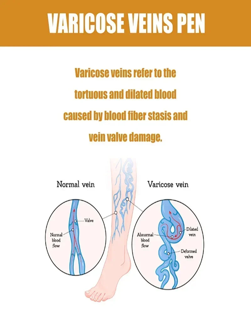 Upgrade varicose veins laser pen, medical grade 980nm infrared therapy device, spider vein and leg blood Painless treatment with