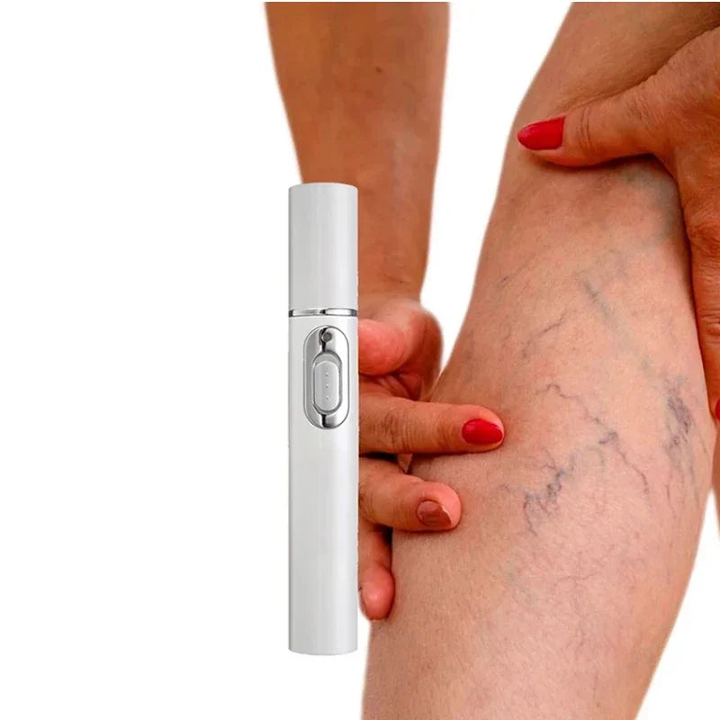 Upgrade varicose veins laser pen, medical grade 980nm infrared therapy device, spider vein and leg blood Painless treatment with