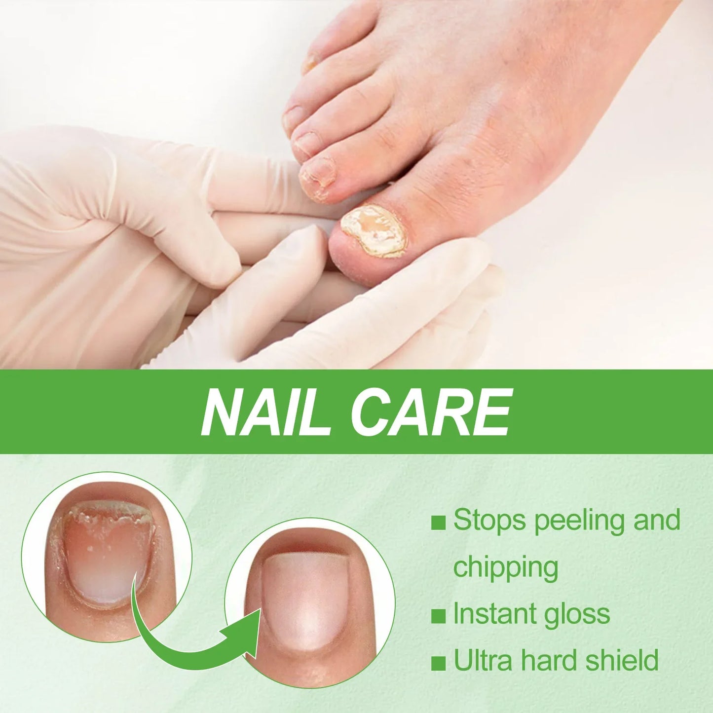 네일 15ML Nail Treatment Growth Formula Protein Normal Nail Strengthener Top Repair Serum Liquid Healthy Care Toe Cuticle Oil