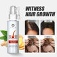 Hair Growth Essence Spray Essential Oil Liquid for Men Women Dry Hair Regeneration Repair Hair Care Anti Hair Loss Products