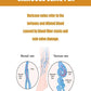 Upgrade varicose veins laser pen, medical grade 980nm infrared therapy device, spider vein and leg blood Painless treatment with
