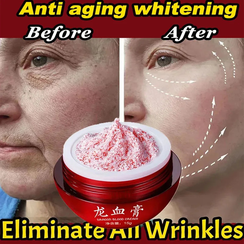 Dragon's Blood Face Cream Effective Whitening Freckle Remove Melasma Cream Remove Dark Spots Melanin Skin Care Cosmetics 15g