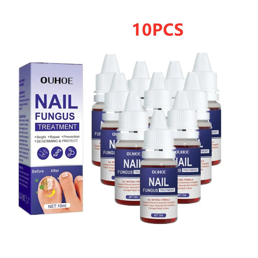 10PCS Nail Fungal Treatment Feet Care Essence Anti Infection Paronychia Toe Fungus Repair Nail Fungal Serum Removal Onychomy