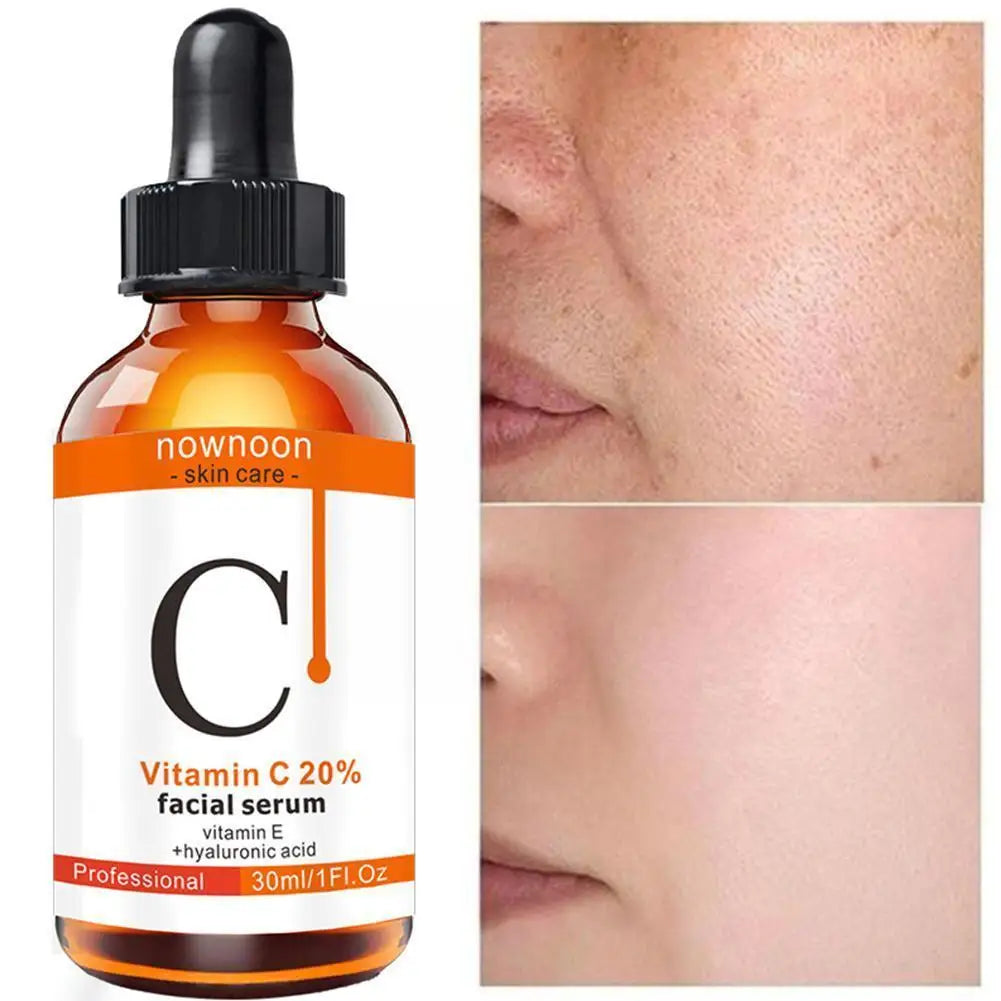 1Pc Vitamin C Serum, Retinol Serum and Hyaluronic Acid Spots Wrinkle Anti Remove Whitening Serum Facial Serum Facial Dark R4E1